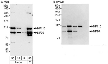 Rabbit NF90/NF110 Antibody