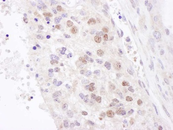 Rabbit NF90/NF110 Antibody