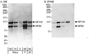 Rabbit NF90/NF110 Antibody