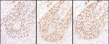 Rabbit HEXIM1 Antibody
