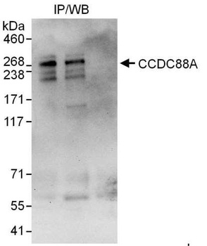 Rabbit CCDC88A Antibody