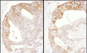 Rabbit EBP1 Antibody