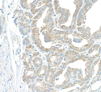 Rabbit EBP1 Antibody