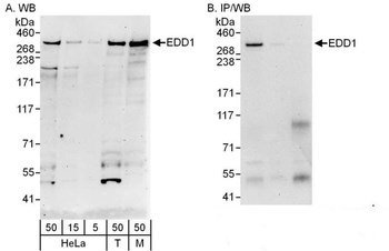 Rabbit EDD1 Antibody