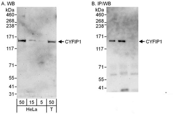 Rabbit CYFIP1 Antibody