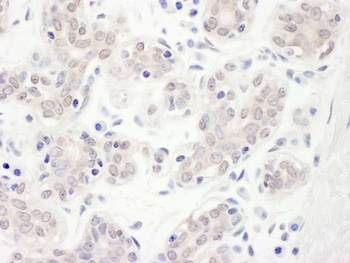 Rabbit Hakai Antibody