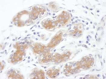 Rabbit ALIX Antibody
