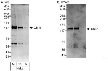 Rabbit Cbl-b Antibody