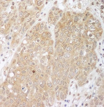 Rabbit Cbl-b Antibody
