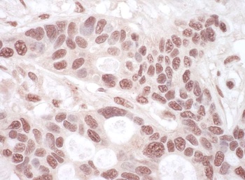 Rabbit THOC1 Antibody