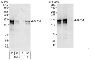 Rabbit SLTM Antibody