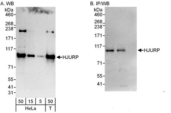 Rabbit HJURP Antibody