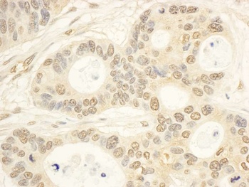 Rabbit CIAPIN1 Antibody