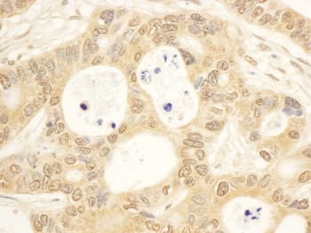 Rabbit CIAPIN1 Antibody
