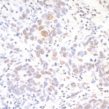 Rabbit API5 Antibody