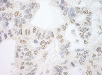 Rabbit PRP6 Antibody