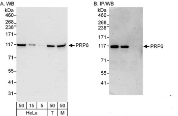 Rabbit PRP6 Antibody