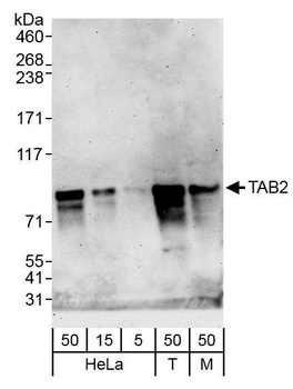 Rabbit TAB2 Antibody