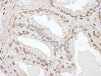 Rabbit C/EBP beta Antibody