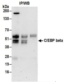 Rabbit C/EBP beta Antibody
