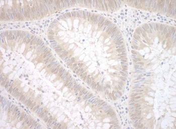 Rabbit TDP2 Antibody
