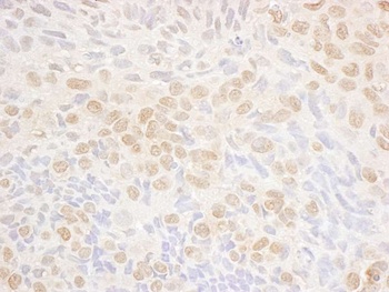 Rabbit DRAK1 Antibody