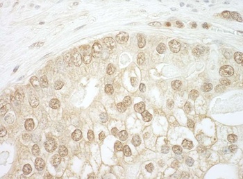 Rabbit CNOT2 Antibody