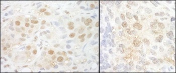 Rabbit NCBP2 Antibody