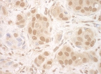 Rabbit NCBP2 Antibody