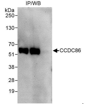 Rabbit CCDC86 Antibody