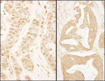 Rabbit BTF3 Antibody