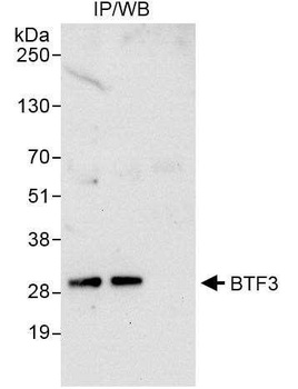 Rabbit BTF3 Antibody