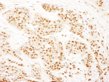 Rabbit RAD23B Antibody