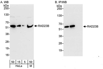 Rabbit RAD23B Antibody