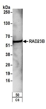 Rabbit RAD23B Antibody