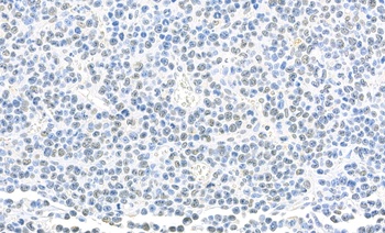 Rabbit SET Antibody