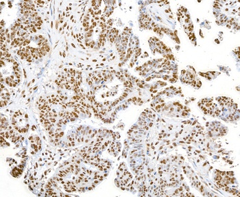 Rabbit SET Antibody