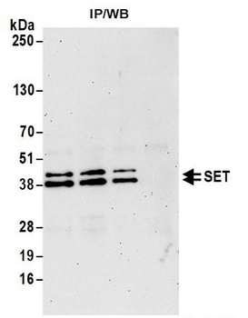 Rabbit SET Antibody