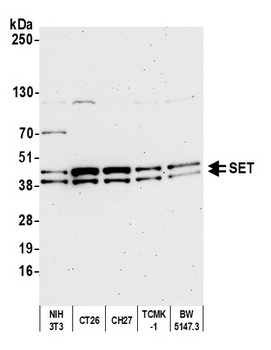 Rabbit SET Antibody