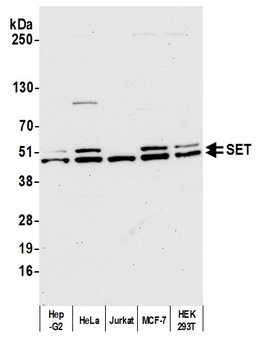 Rabbit SET Antibody