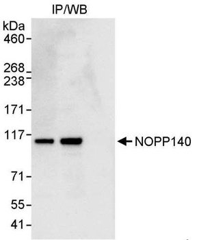 Rabbit NOPP140 Antibody