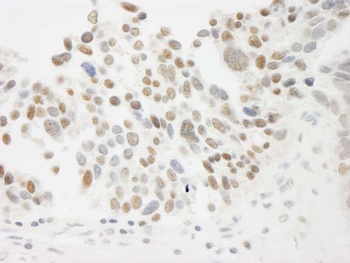 Rabbit THOC5 Antibody