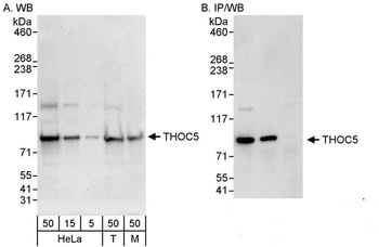 Rabbit THOC5 Antibody
