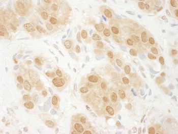 Rabbit ERK1 Antibody