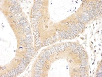 Rabbit ABC50 Antibody