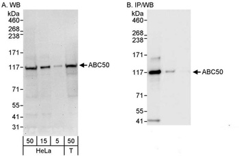 Rabbit ABC50 Antibody