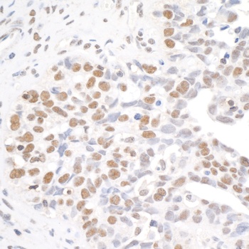 Rabbit BRD4 Antibody