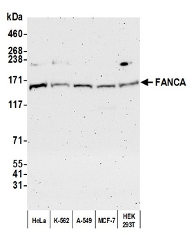 Rabbit FANCA Antibody