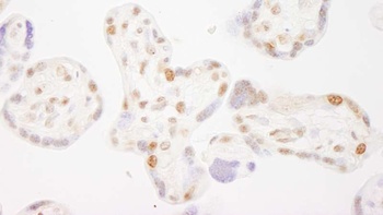 Rabbit COBRA1 Antibody