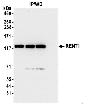 Rabbit RENT1 Antibody